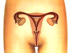 Cómo se realiza — DIU hormonal / sistema intrauterino