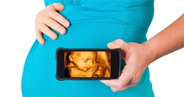 How it is carried out — Viability and dating ultrasound